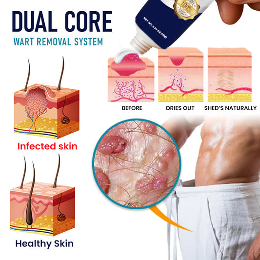 Alisanda® Genital Warts Remover Cream 👨Designed for Men
