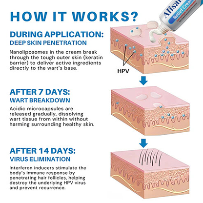 Alisanda® HPV Genital Warts Relief Cream